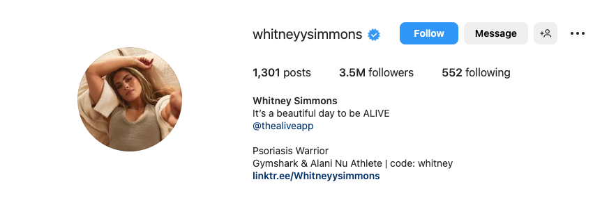 Whitney Simmons的全网粉丝超过500万